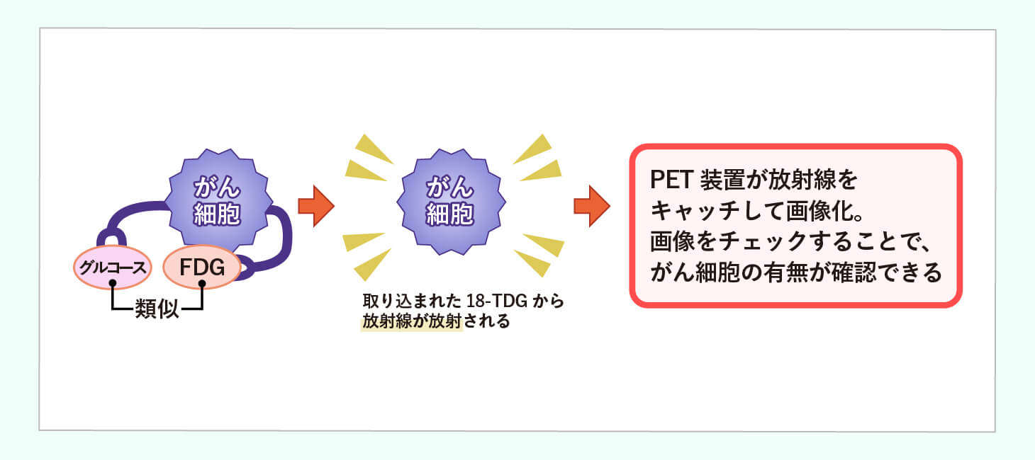 肺がんの検査のイメージ画像