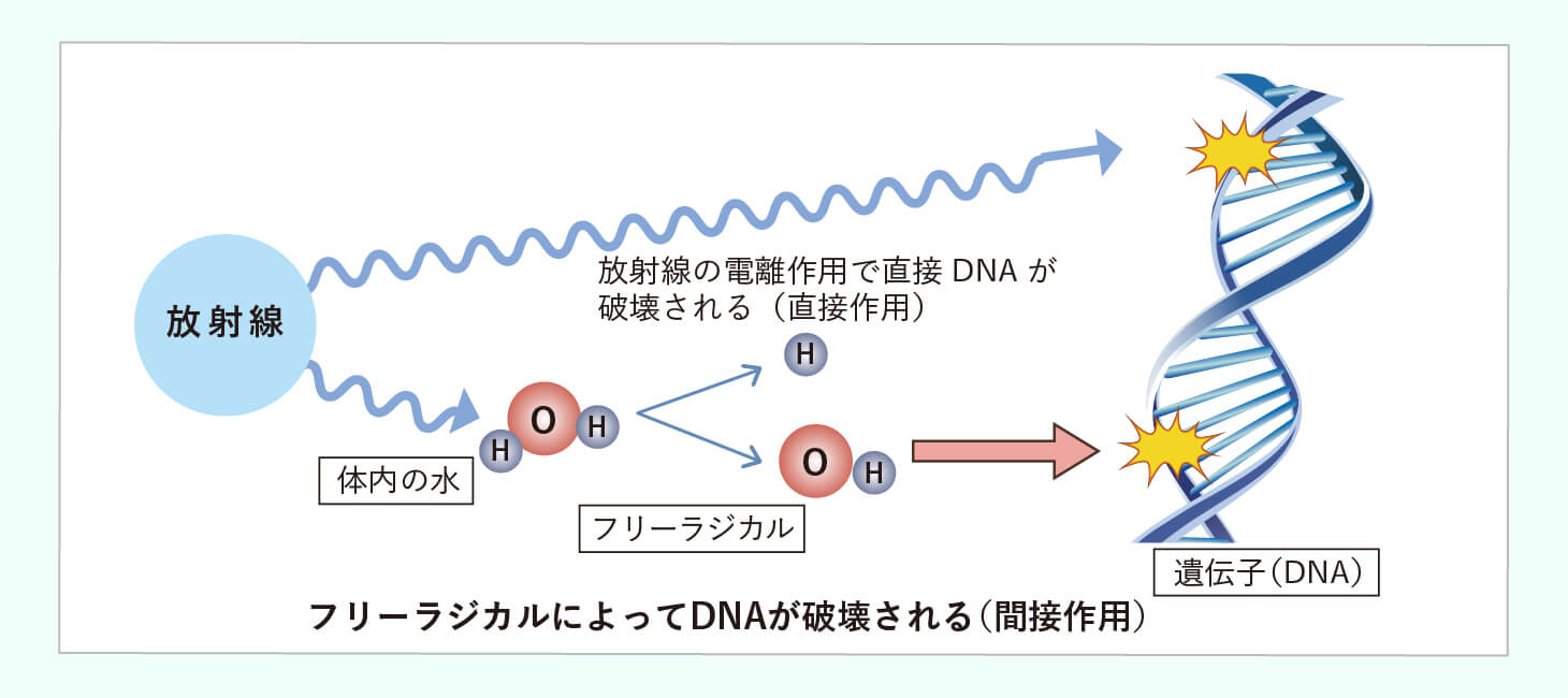 メスを使わずがんを叩くのイメージ画像
