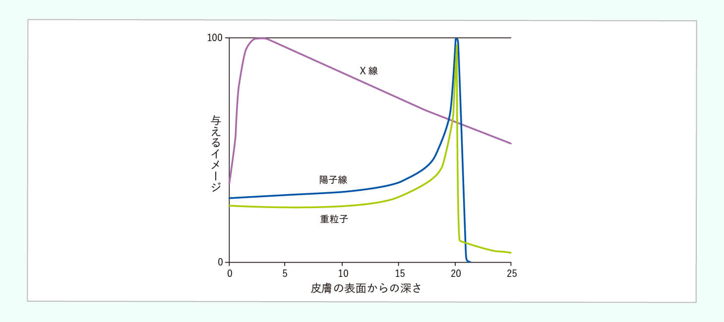 粒子線治療のイメージ画像