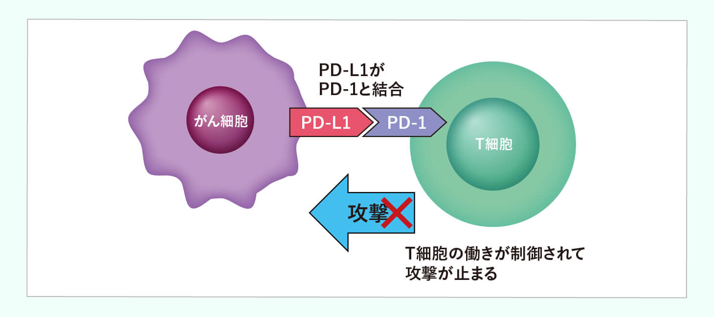 非小細胞肺がん ステージⅣの治療法のイメージ画像