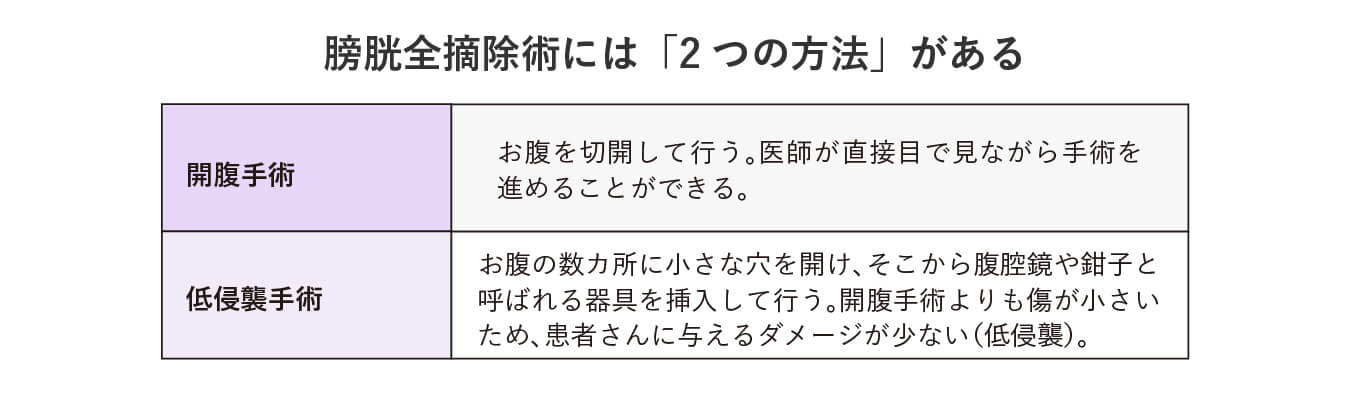 膀胱全摘除術には「2つの方法」がある
