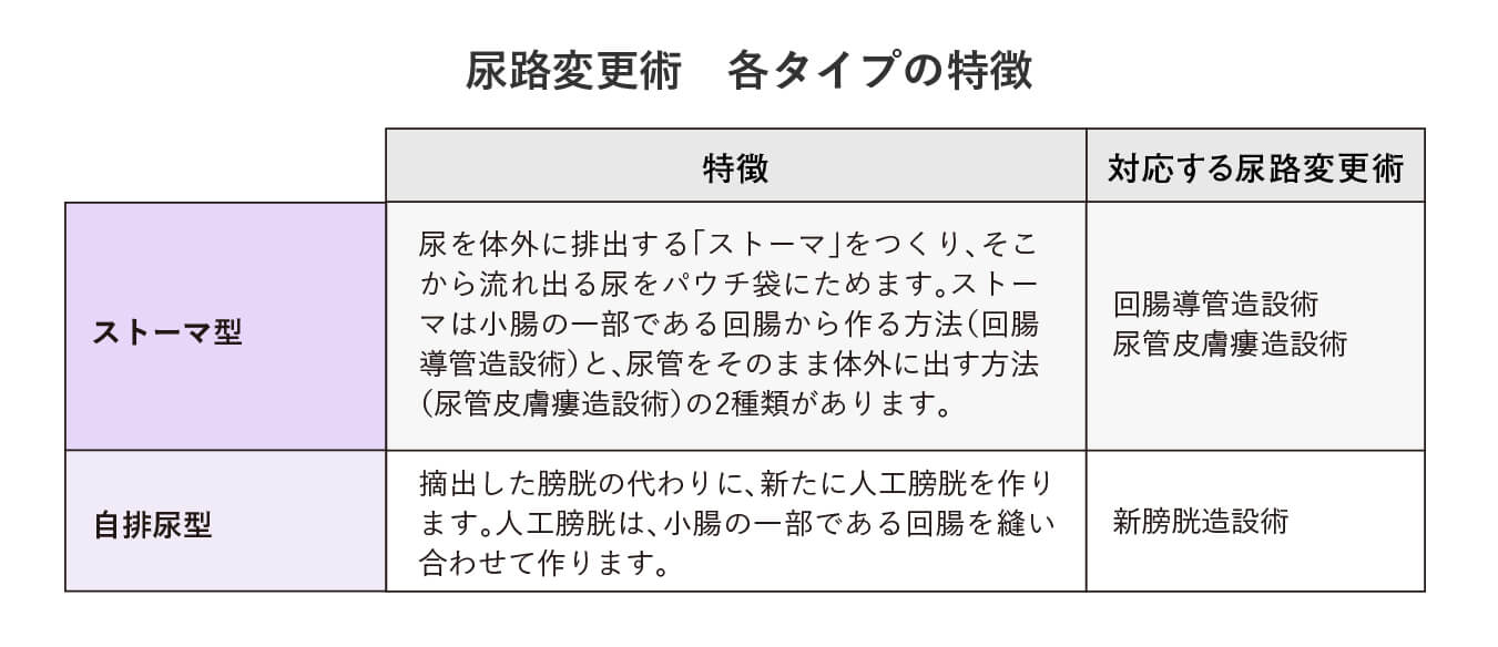 尿路変更術 各タイプの特徴
