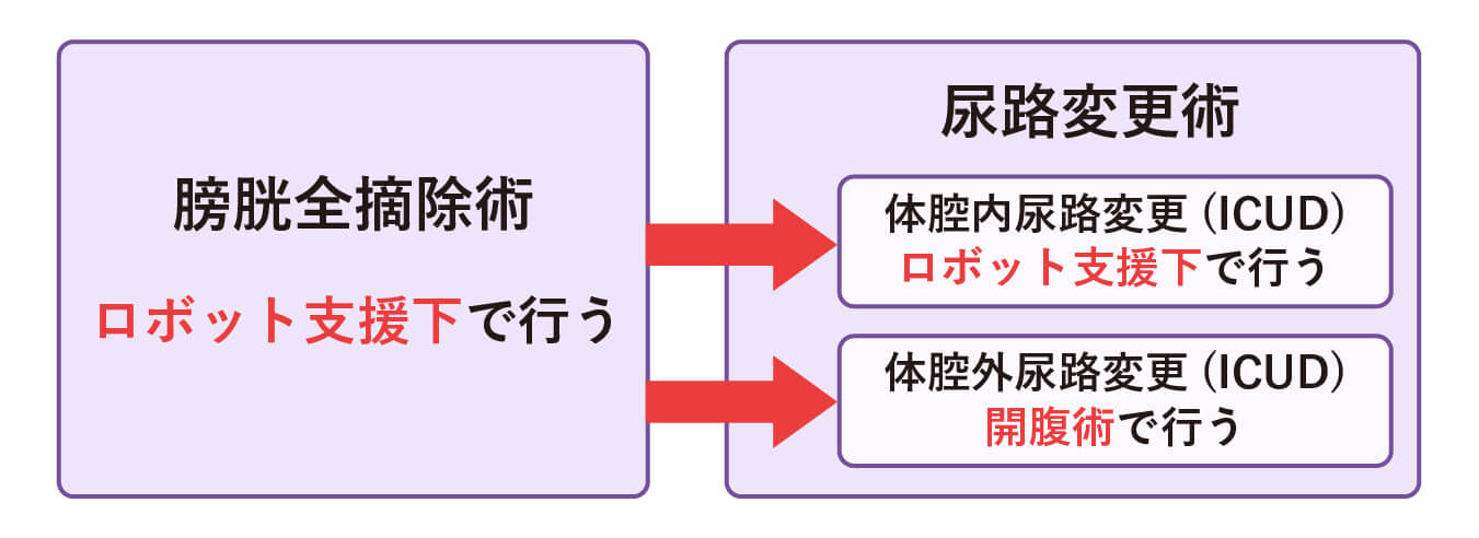 筋層浸潤性膀胱がんの手術療法では、「膀胱全摘除術」の後に「尿路変更術」を行う