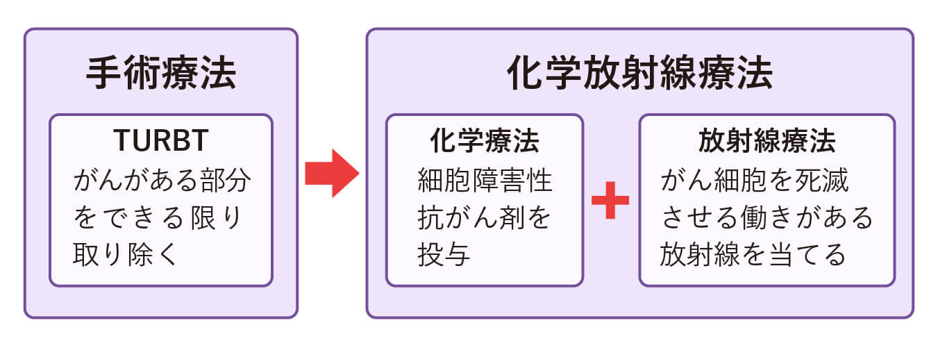 膀胱温存療法は、TURBTを行った後、化学療法と放射線療法を同時期に行う「化学放射線療法」を行う