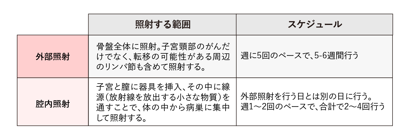 放射線の照射方法とスケジュール