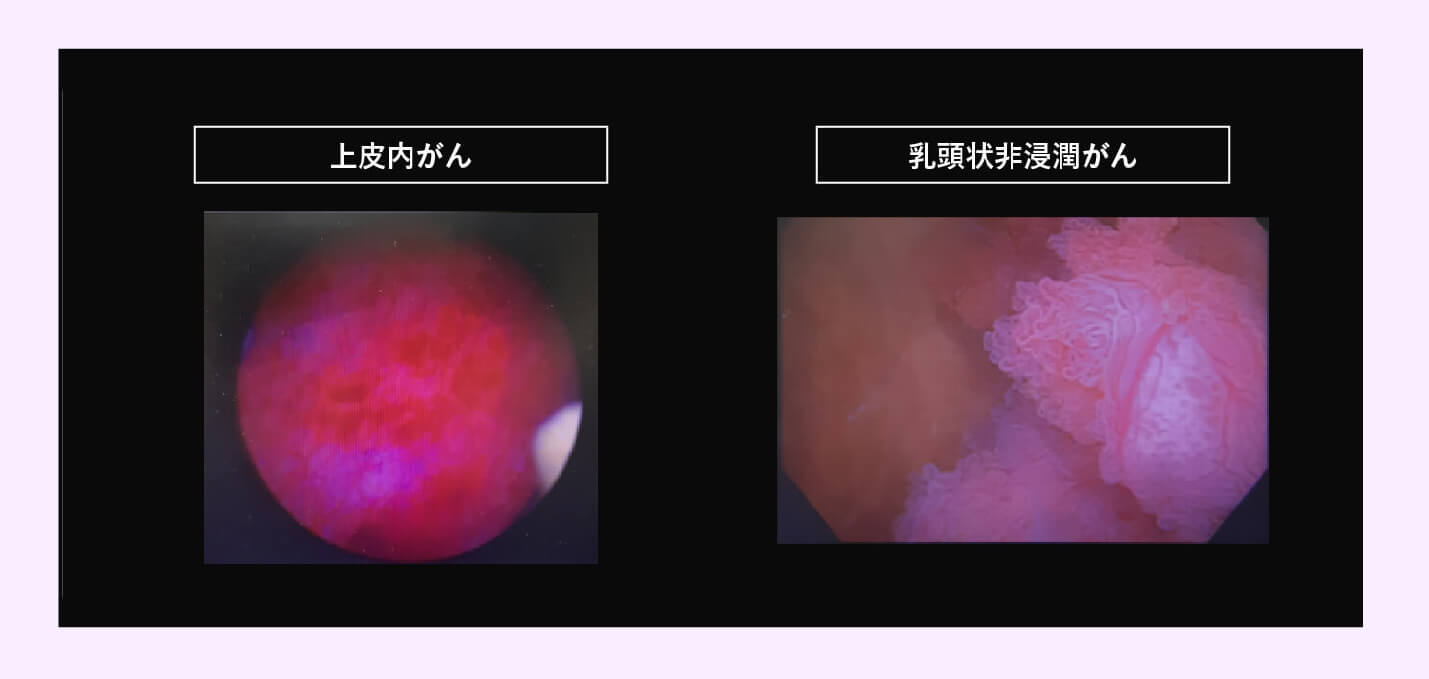 サポートグループはどこで見つけられますか?