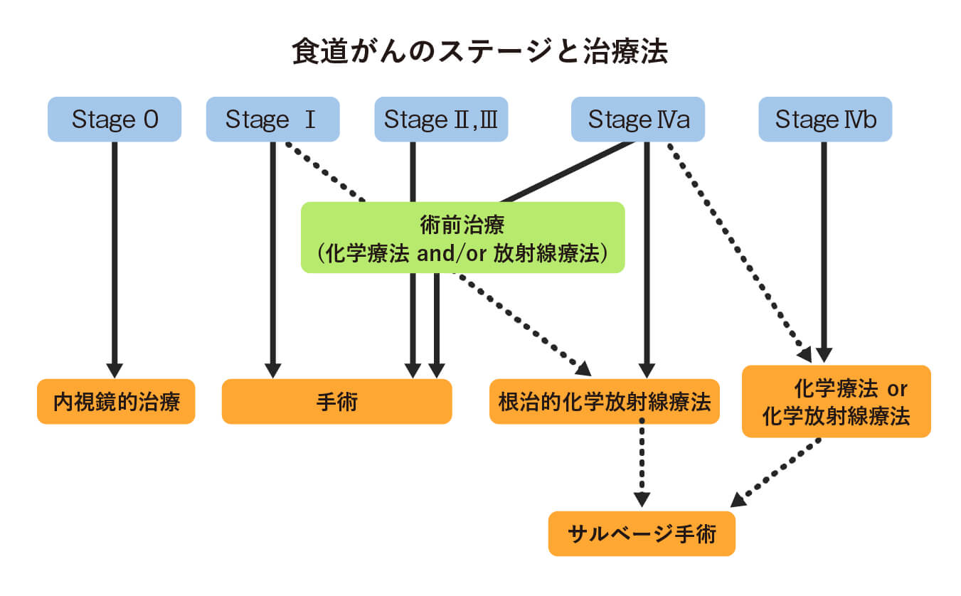 トラスツズマブ (ハーセプチン)
