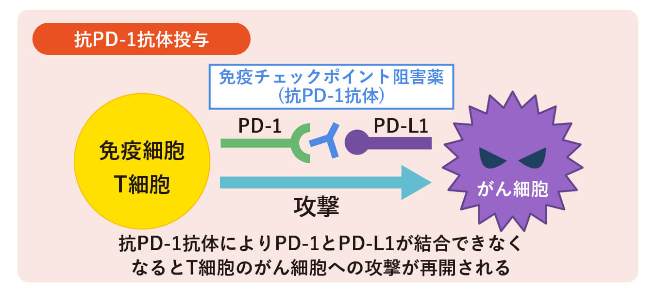 抗PD-1抗体投与