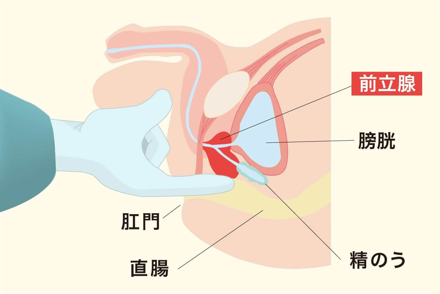 確定診断までの流れ がんの治療法 詳しく知りたい 前立腺がん